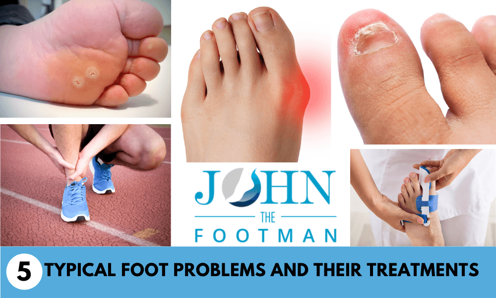 5 Typical Foot Problems and Their Treatments